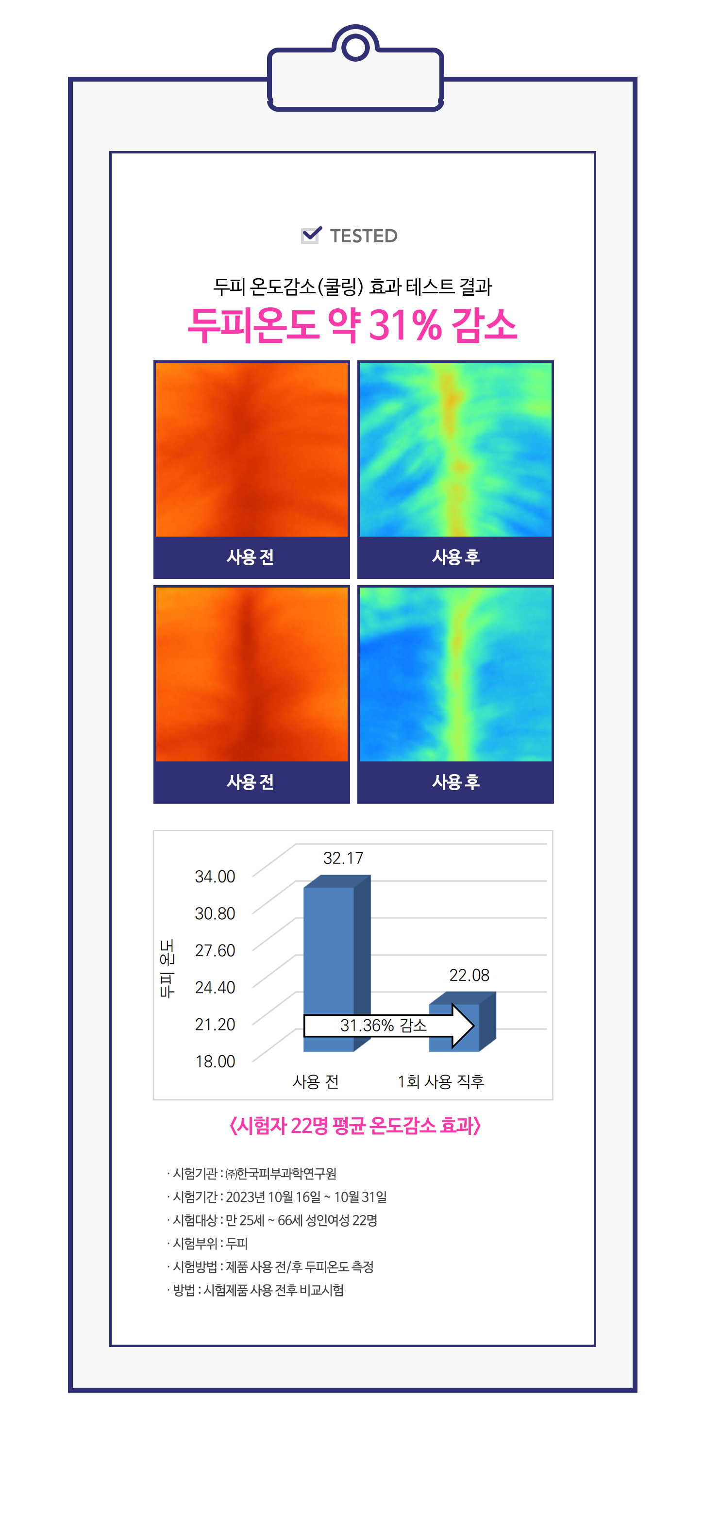 스칼프 스프레이